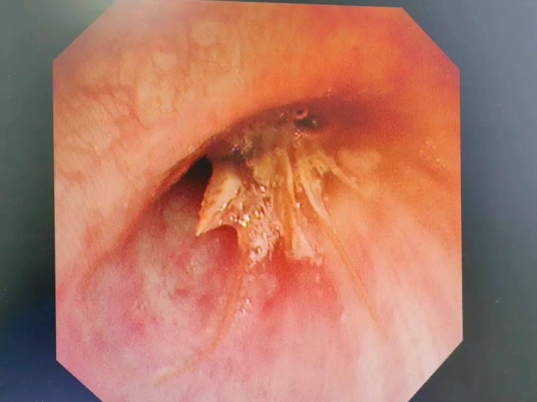 将东阳市中医院微信公众号设为星标