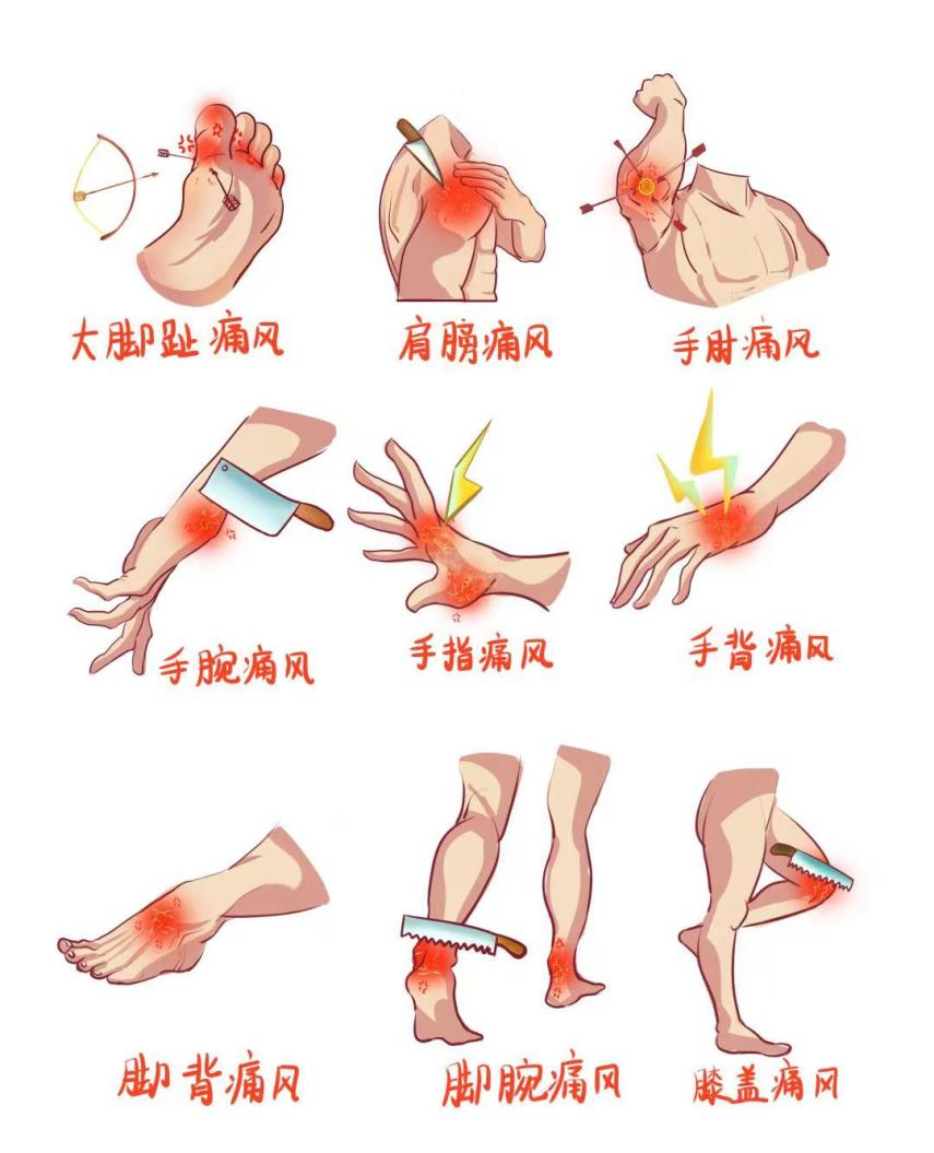 年纪轻轻得了痛风,竟是那"快乐肥宅水"的锅!_尿酸_治疗_代谢