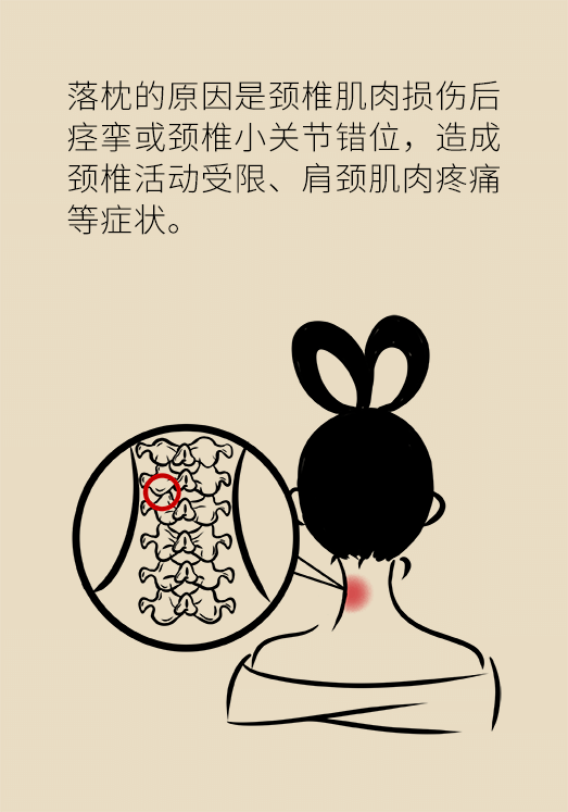 什么是落枕 来自搜狐网