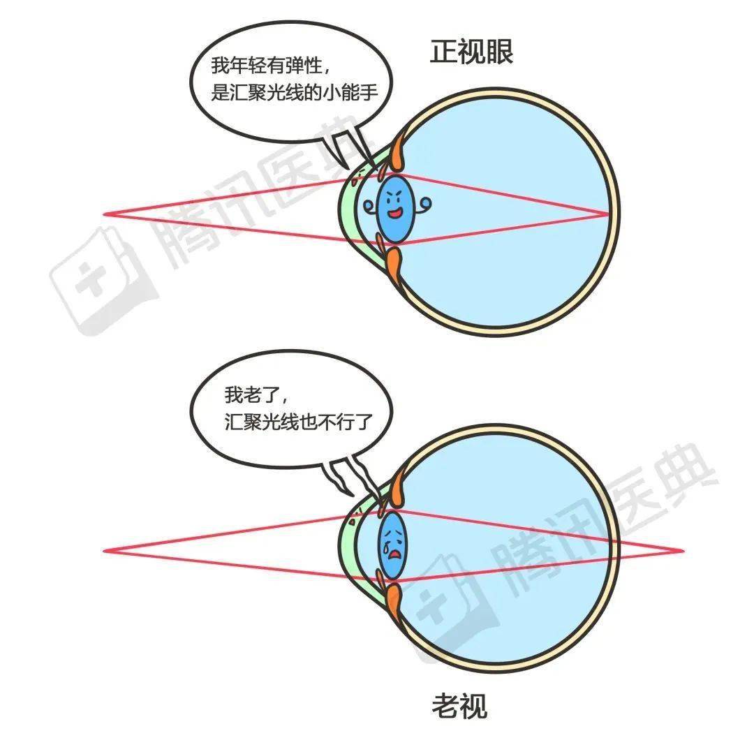 来源_晶状体_距离