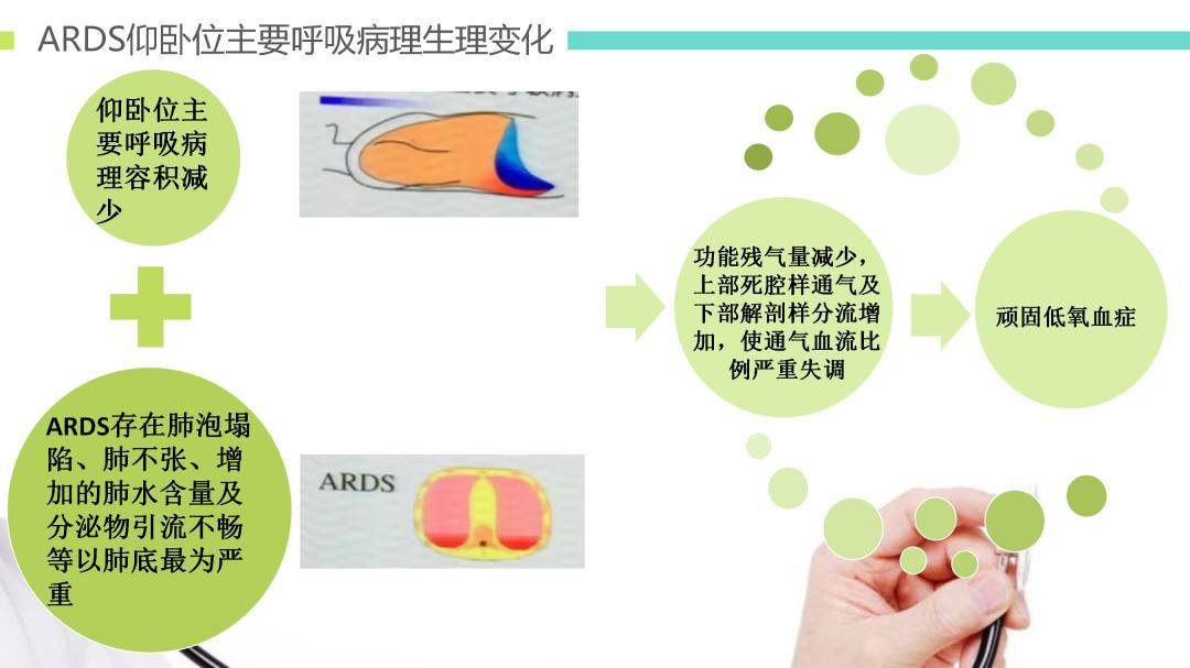 【ppt】ards患者俯卧位通气治疗