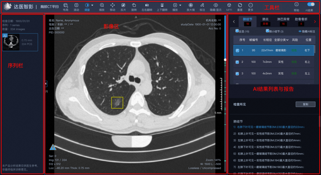 一般还需要通过核磁共振或增强ct才能发现
