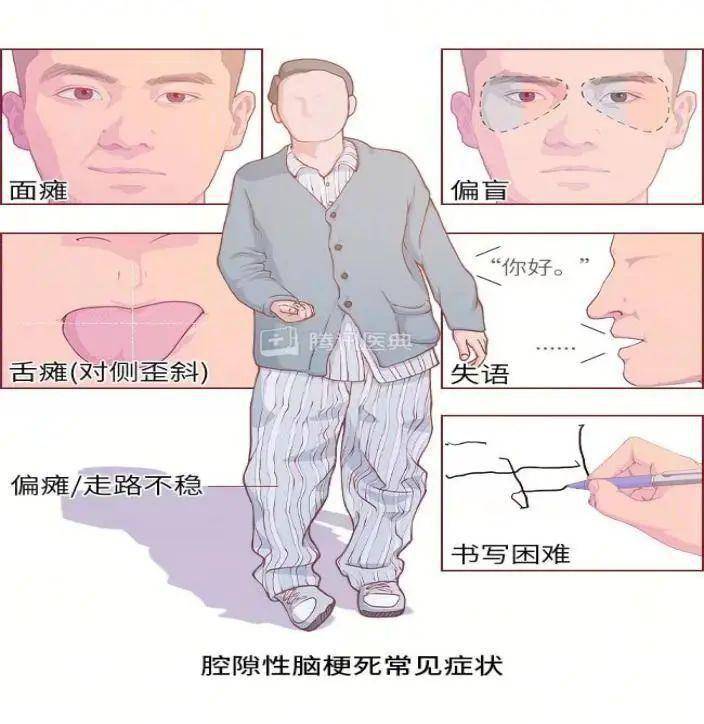 腔隙性脑梗死是哪般?和济医院解答