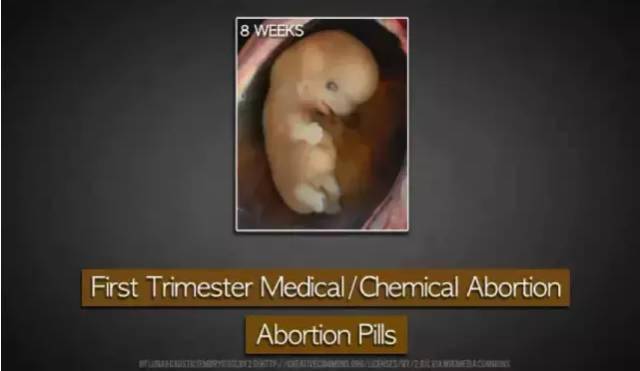 大学生两年捡了3000多个死胎_胎儿_尸体_进行