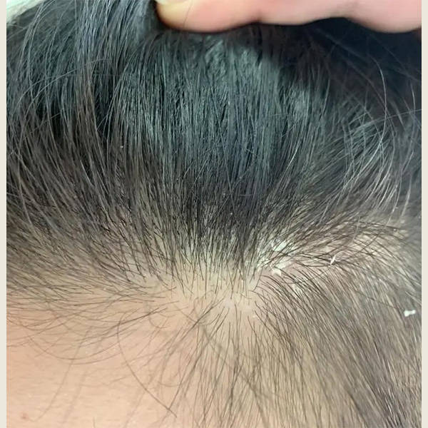 止屑止痒最好的洗发水推荐_头皮_问题_油脂