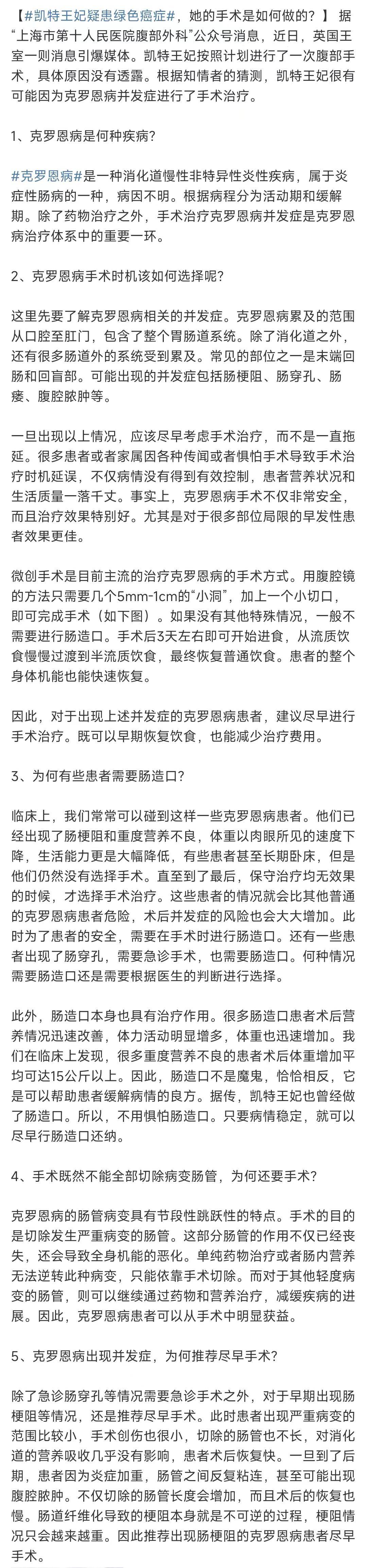 凯特王妃到底怎么了!_公众_消息_住院