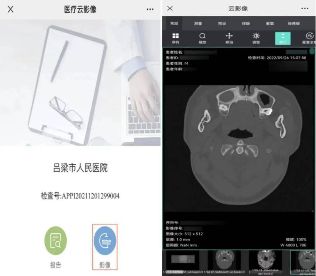 方式二:短信链接查看数字影像当诊断医生审核完检查报告后,系统会向该