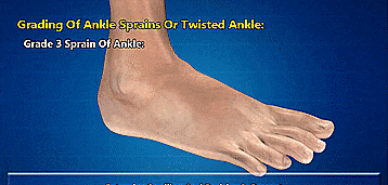 别不当回事,有人后悔一辈子_手术_检查_郑州