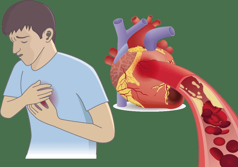 7种疼痛可能是心梗前兆记住这些关键时刻能救命