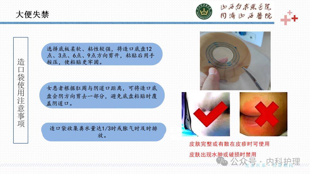 【ppt】成人失禁相关性皮炎的识别与护理