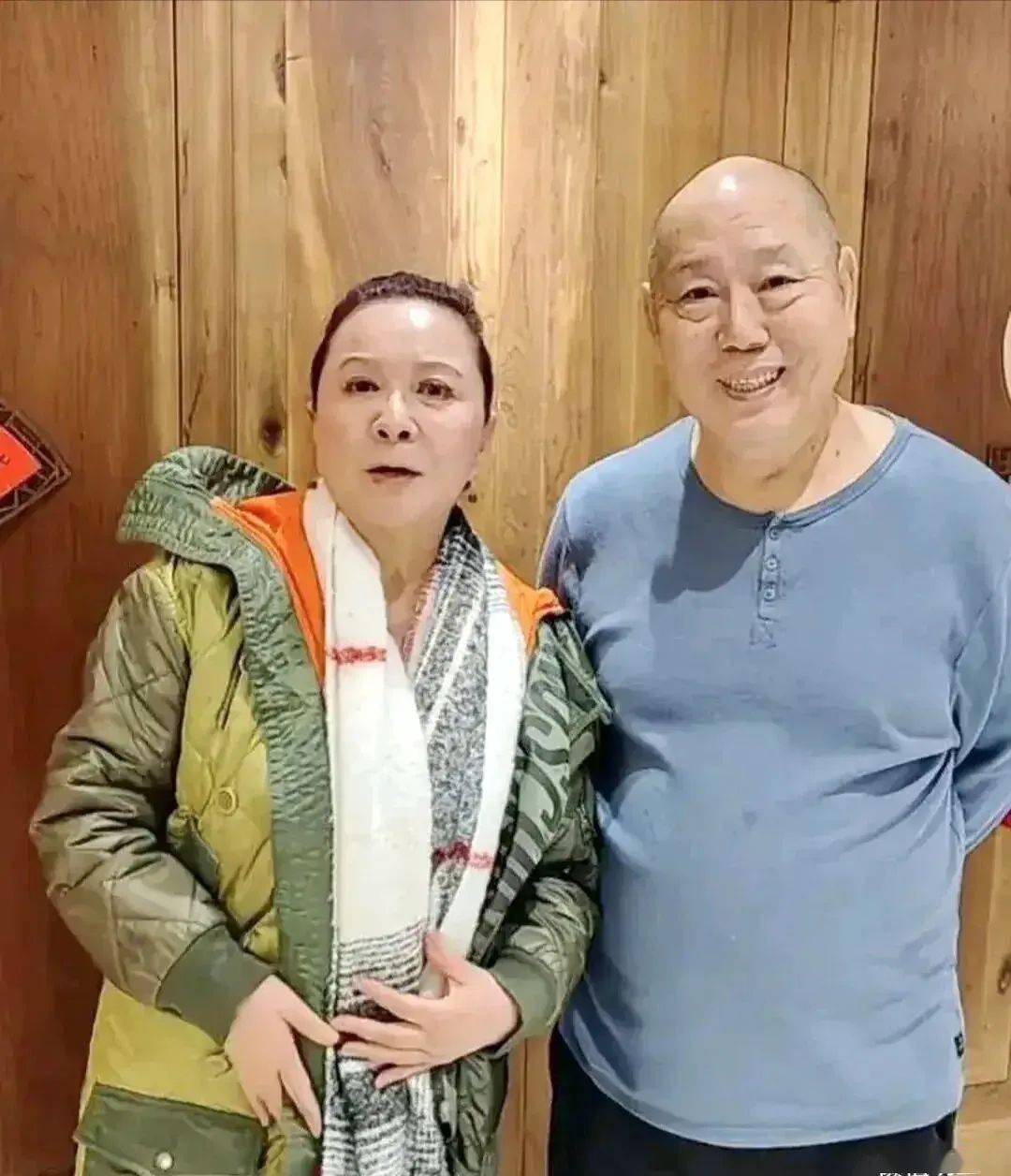 蔡明跟老友合影脸饱满的像个大姑娘却越看越僵硬随便一个农家奶奶都比