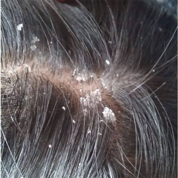 男士去油去屑洗发水哪个好用