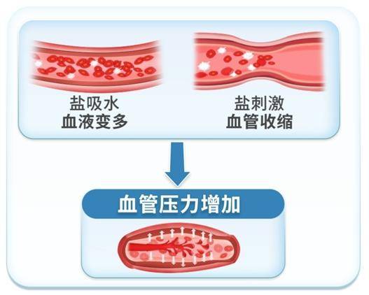 急性肾功能衰竭图片