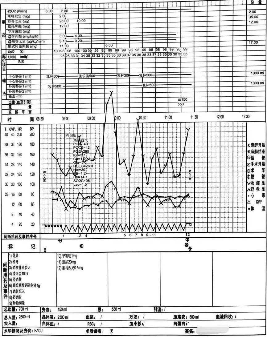 图1 麻醉记录单患者麻醉诱导后,探查肿瘤及夹闭静脉时共出现4次血压的