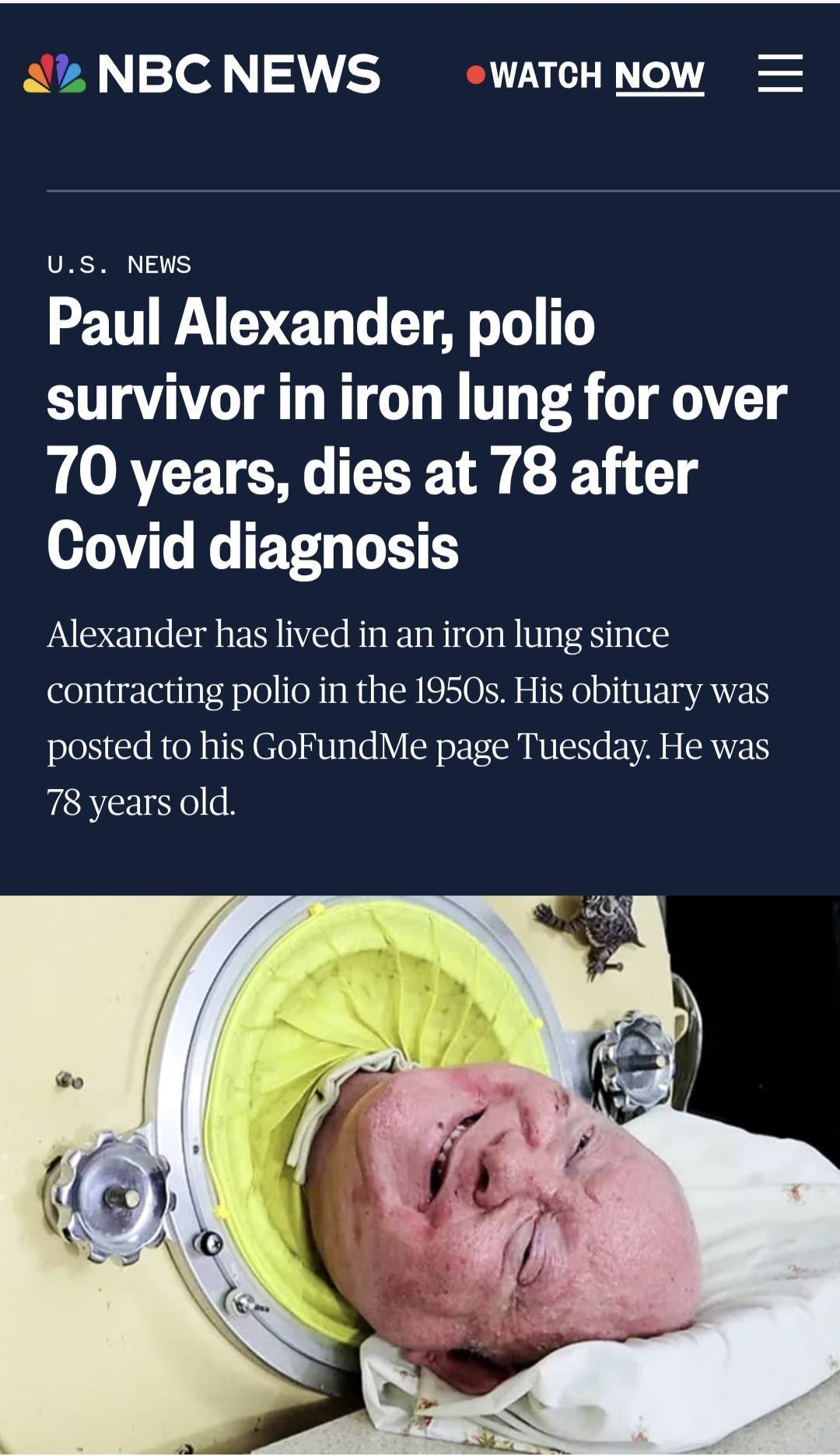 保罗·亚历山大铁肺图片
