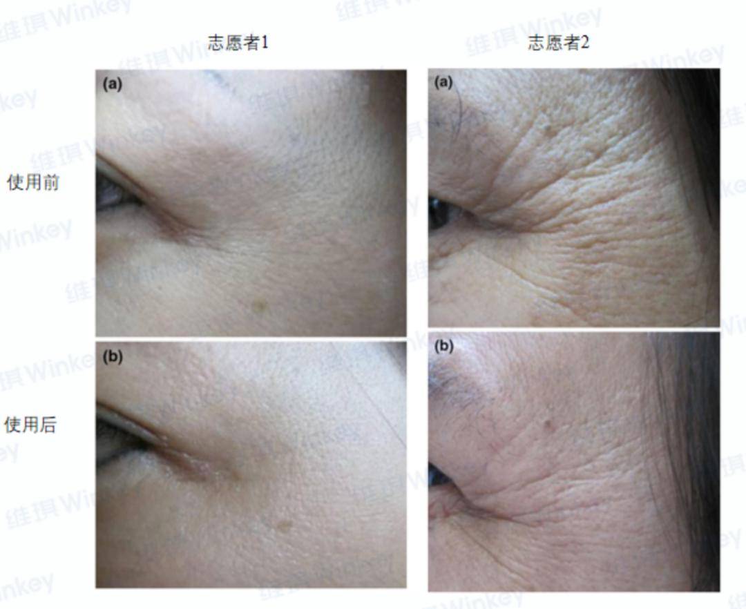 我逢人就推的抗老面霜吊打千元大牌30天内不满意不要钱