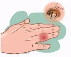 漳州二院给您支招~_伤口_马蜂_毒刺