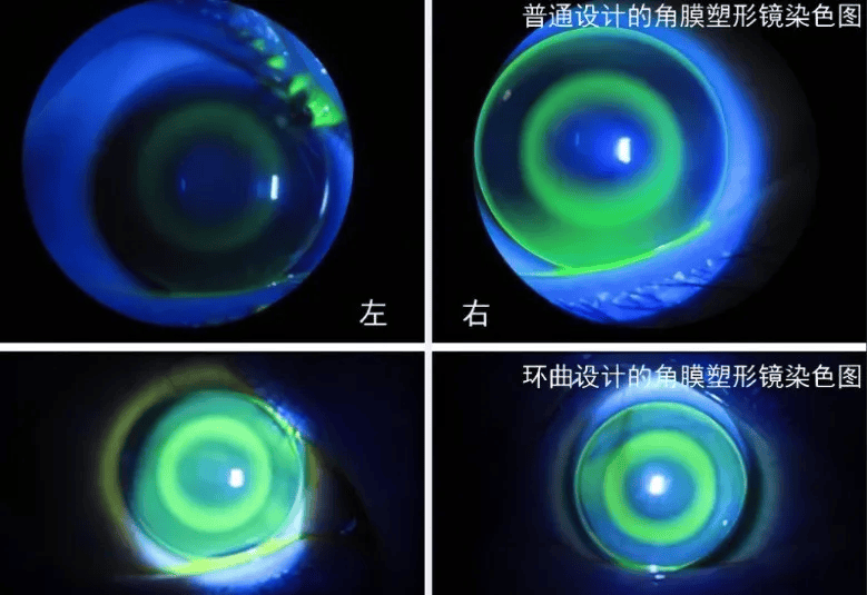 角膜高倍镜图片