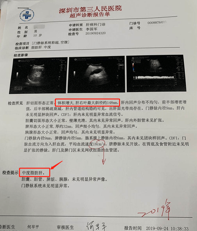 脂肪肝b超报告单图片