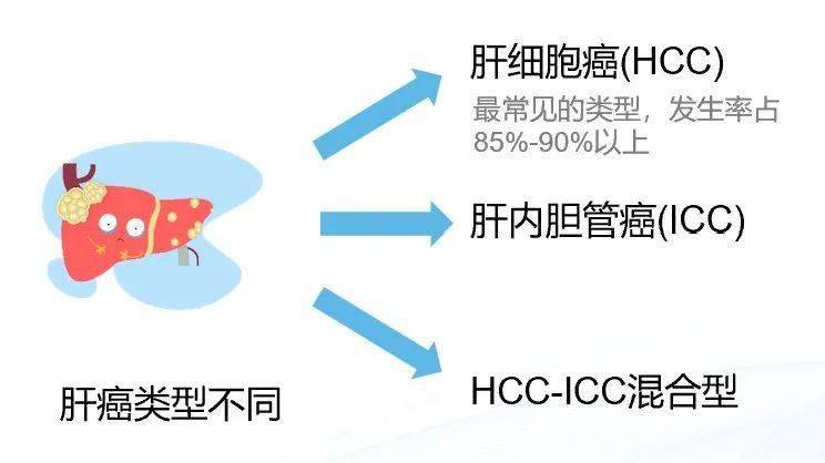 肝癌主要分为原发性肝癌和继发性肝癌两类,原发性肝癌的主要类型有肝