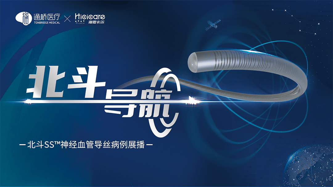 北斗导航后交通动脉瘤栓塞术后复发介入治疗一例