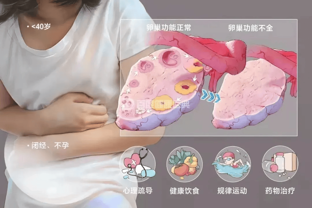 卵巢早衰提前闭经干细胞修复卵巢功能留住青春脚步
