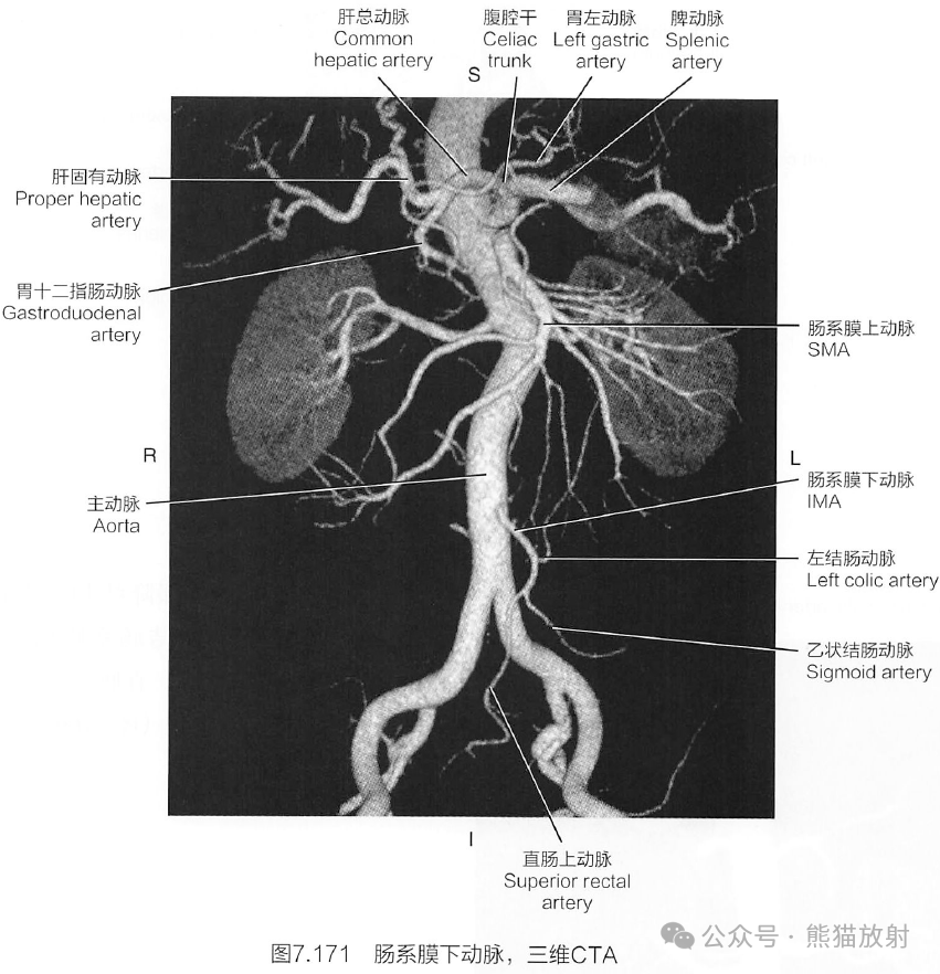 腹主动脉分支解剖图图片