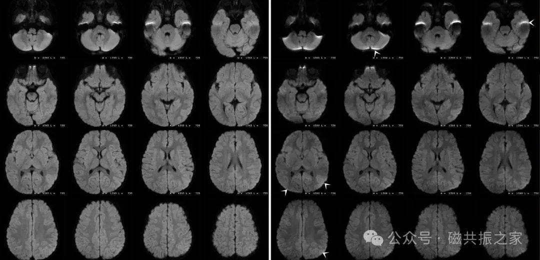 这个成像参数为什么建议你不要随便使用
