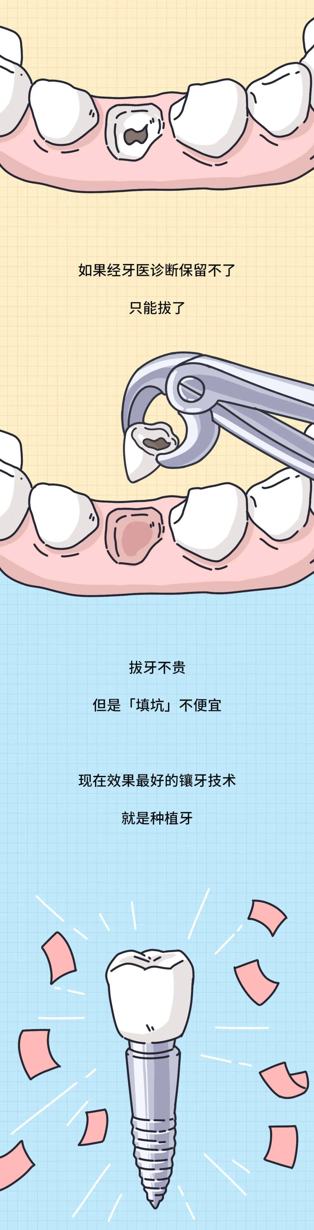 大部分人都有的口腔问题越早治疗越省钱