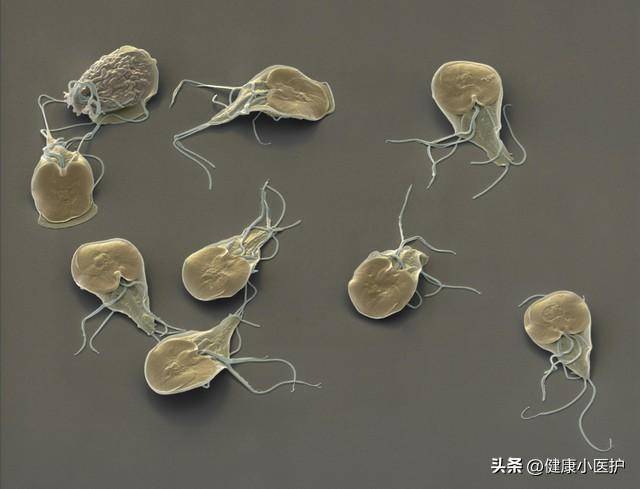 过去几乎人人身上都有虱子为啥现在几乎见不到了虱子是什么