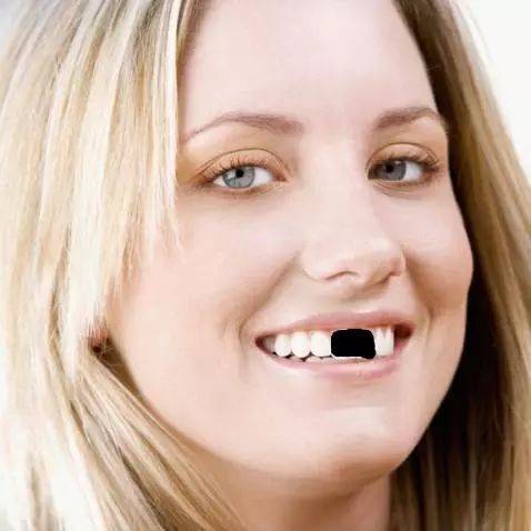 额,男神不再潇洒颜值拉低也不止一条街……无论俊男美女,要是缺了前牙