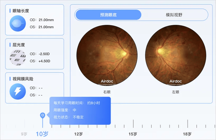 新一代ai眼底相机afc引爆医疗圈_视网膜_产品_人工智能