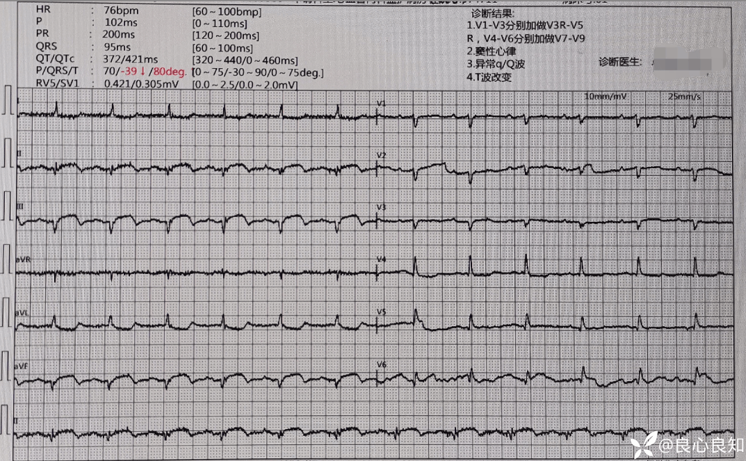 入院 12 导心电图当地心电图当地心电图当地心电图当地心电图体格检查