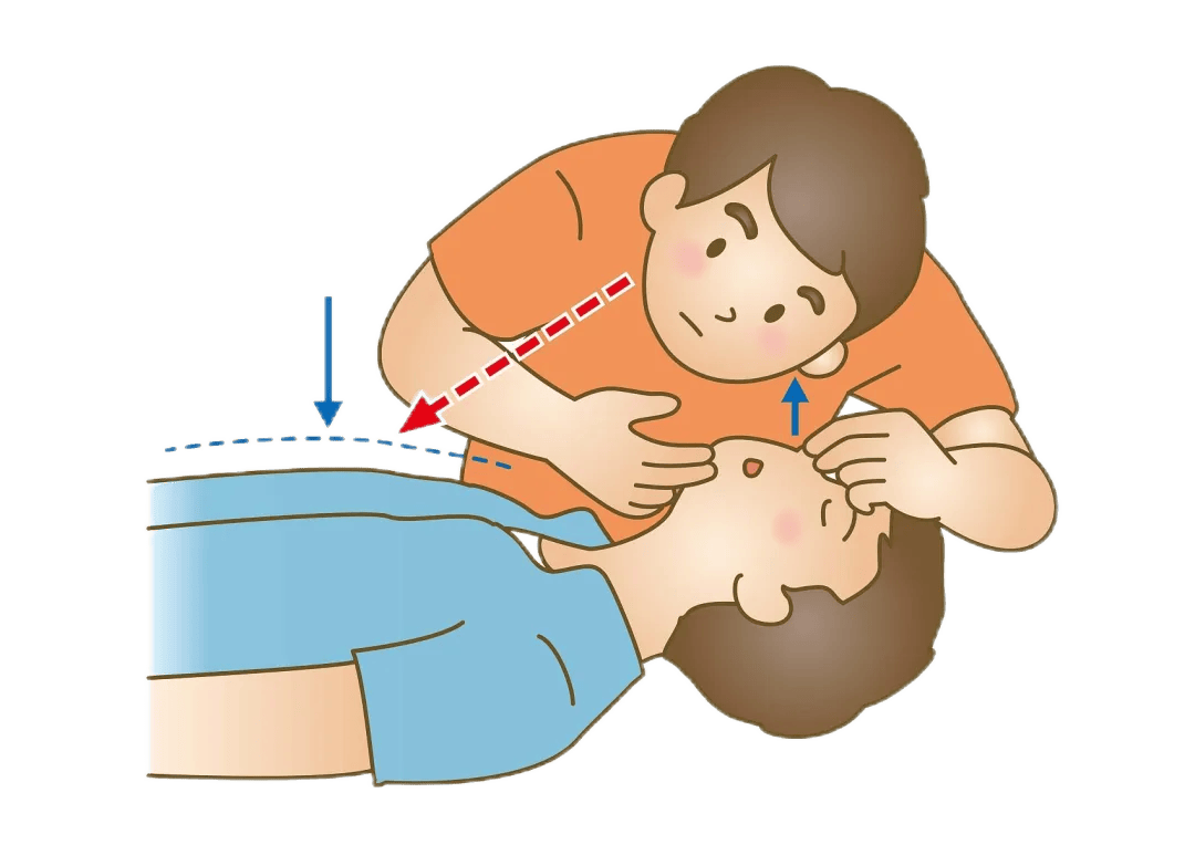 急救科普 | 心肺复苏(cpr)全攻略