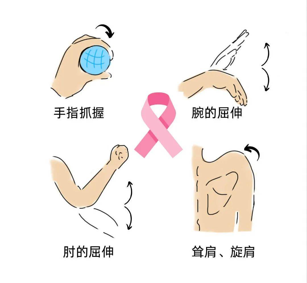 乳腺癌术后爬墙运动图图片