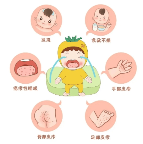 【汤医科普】儿童手足口病预防知识