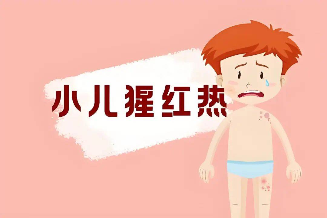 阳泉市疾病预防控制中心健康提示:发热,出疹,谨防猩红热!