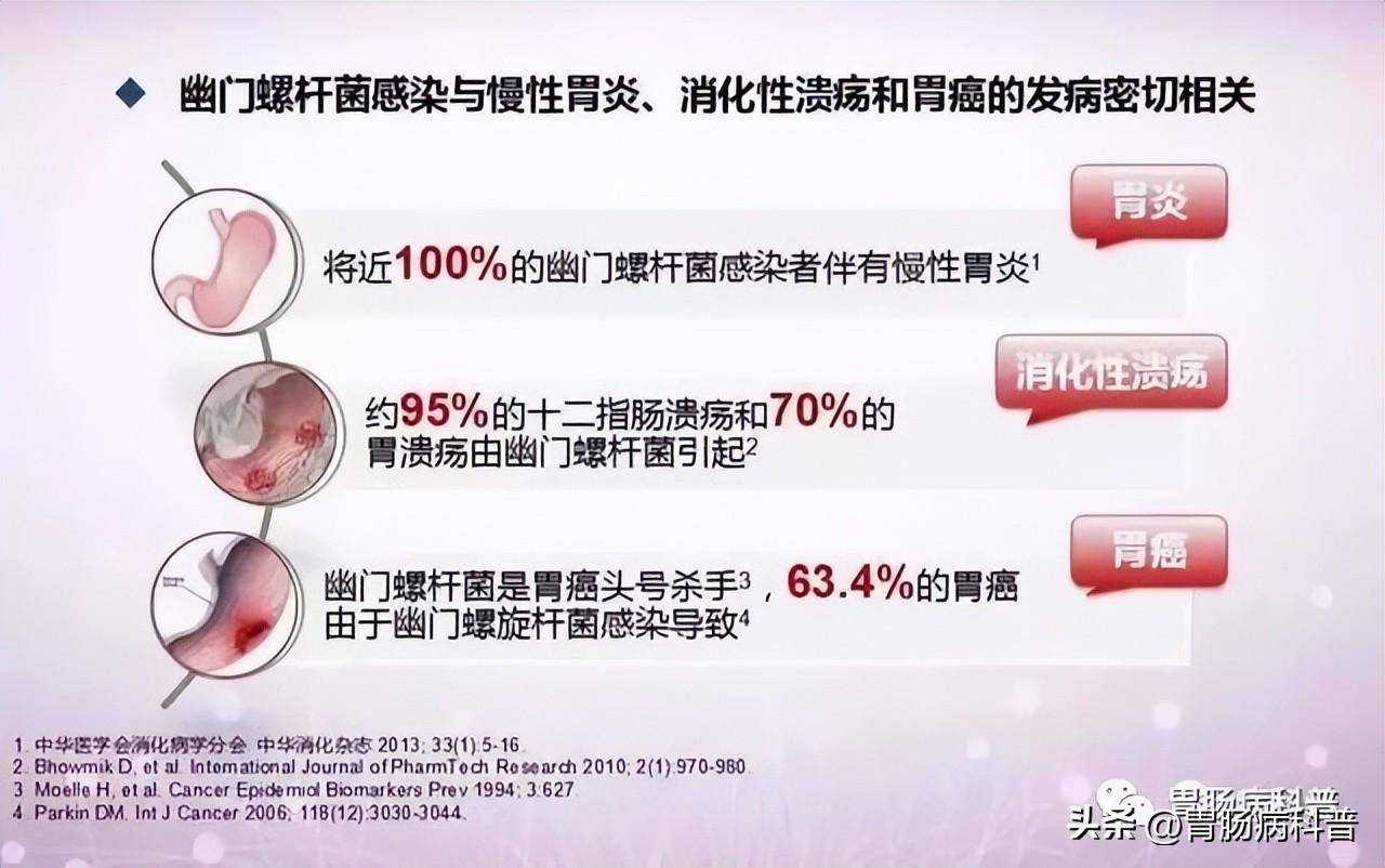 幽门螺旋杆菌(hp)根除治疗的标准方案，建议收藏！