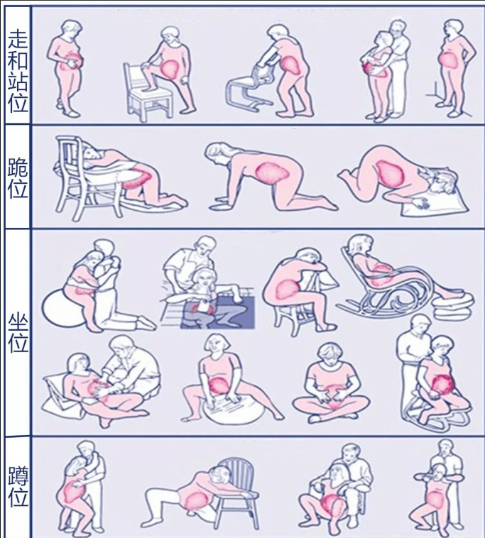 自由体位待产,到底有多自由?