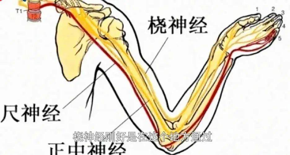 病人出现桡神经损伤后,会感觉前臂皮肤感觉减退,拇指背伸受限,腕下垂
