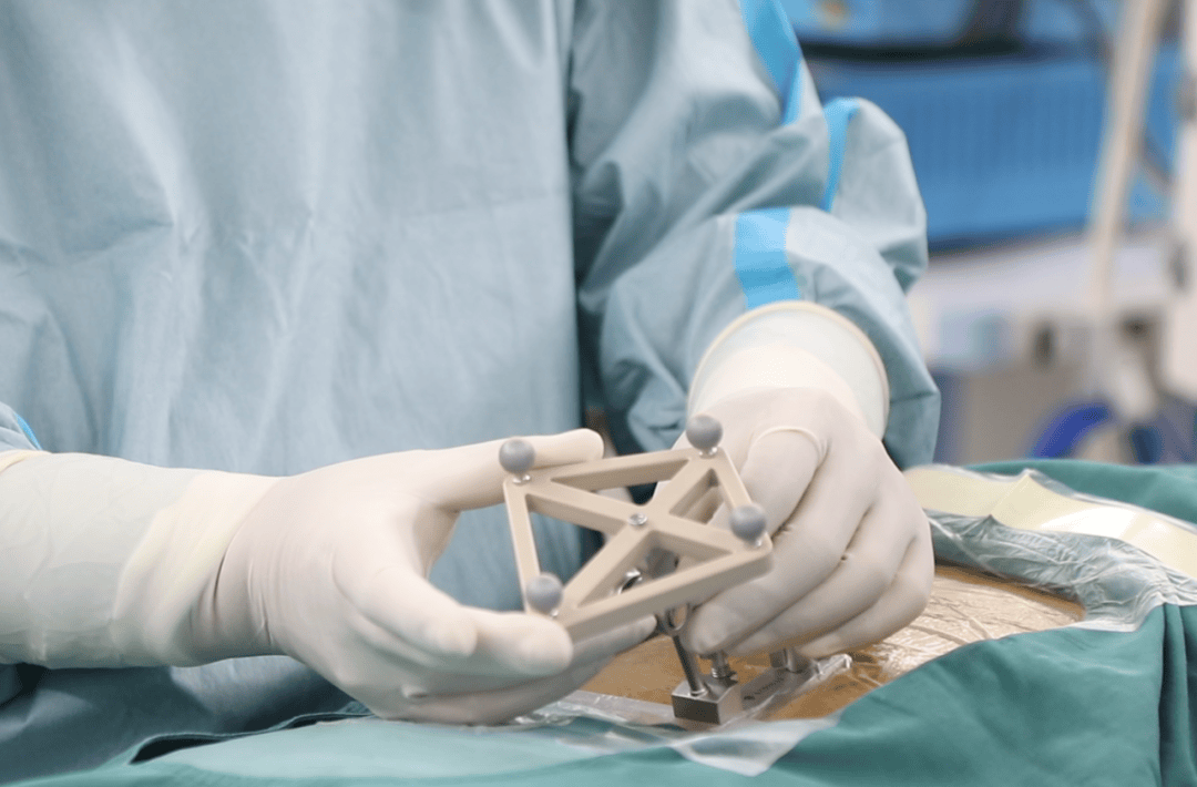 我院成功完成首例骨科手术机器人辅助下的椎体成形术