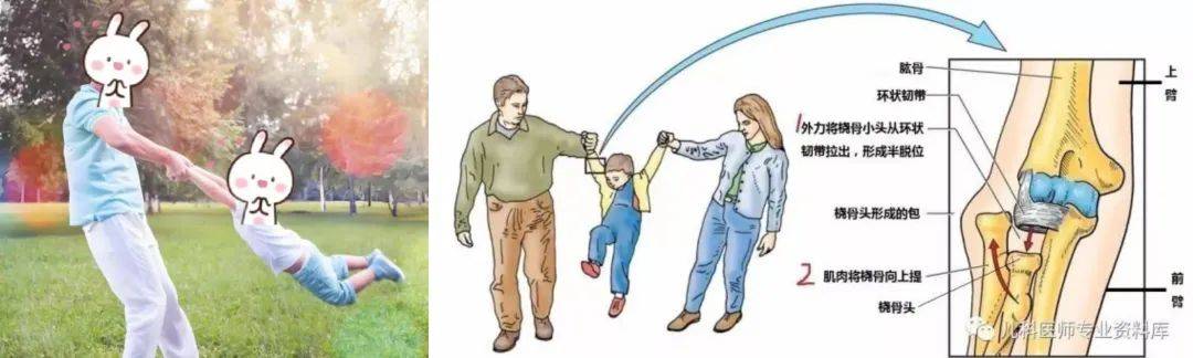 【中医非常道】大手牵小手 小心牵拉肘