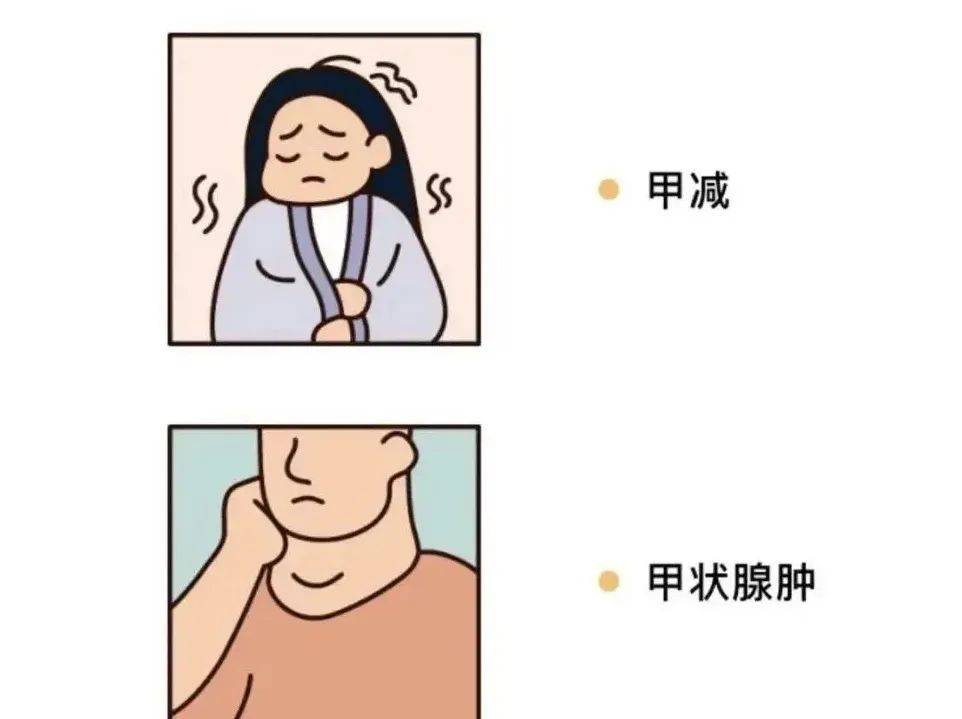 碘缺乏可导致甲状腺功能低下,甲状腺肿大等.4.