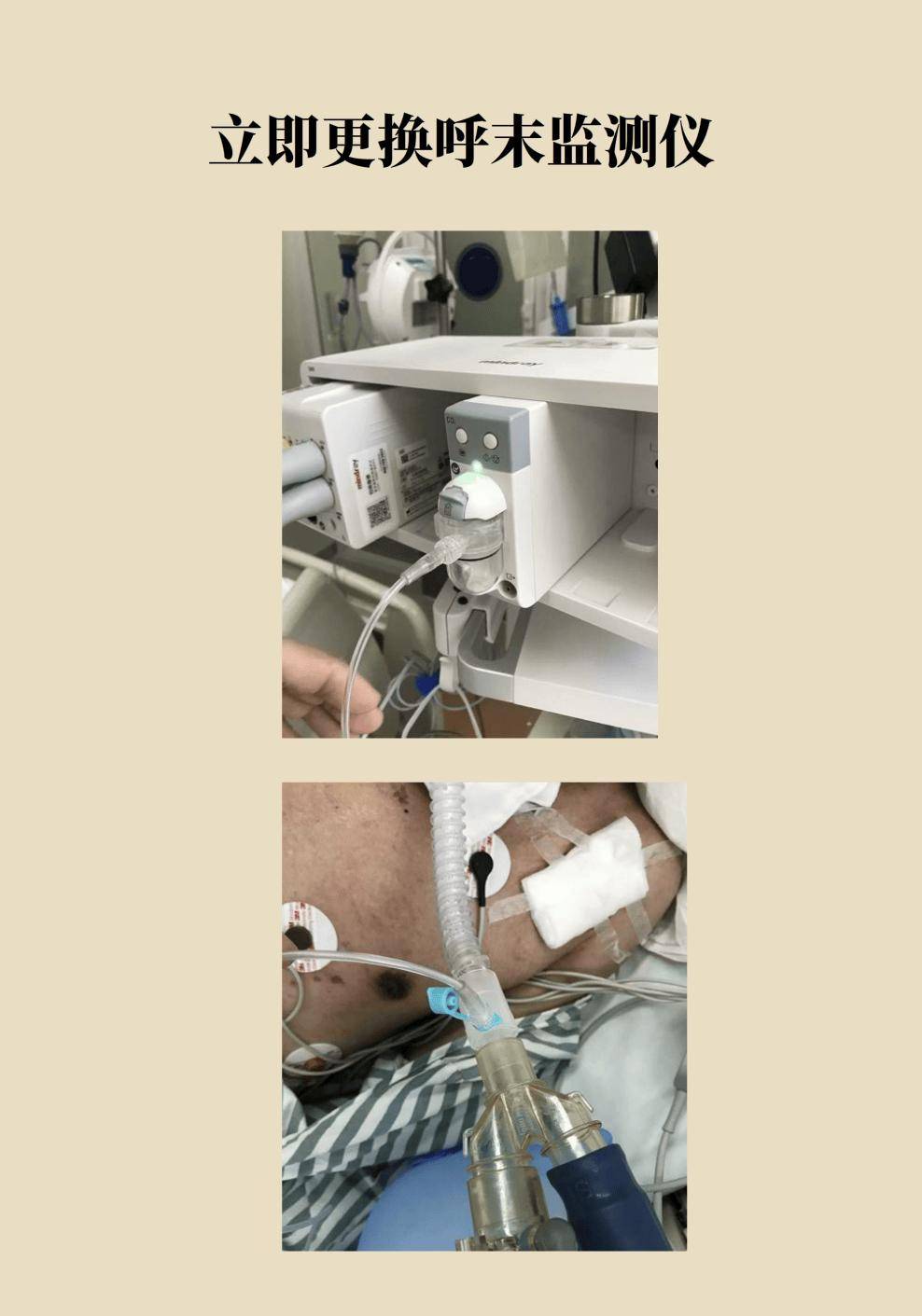 钟sir,快来,呼末co2太高了