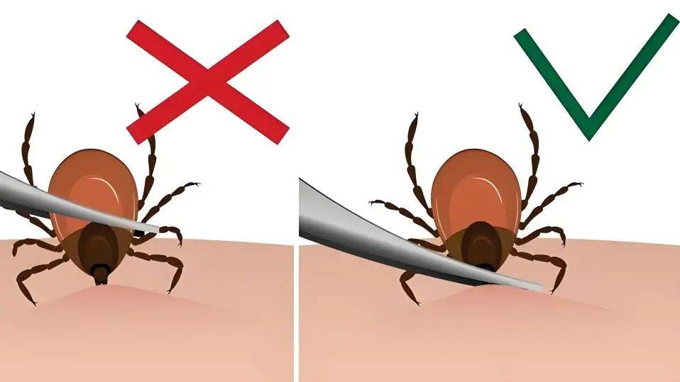 夏季出门需谨防,已有多人中招→_蜈蚣_恙虫_症状