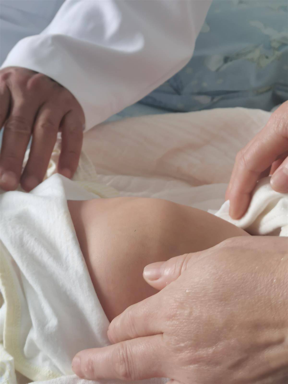 带着比胃大10倍的囊肿出生,6天大的宝宝在汉手术"拆弹"