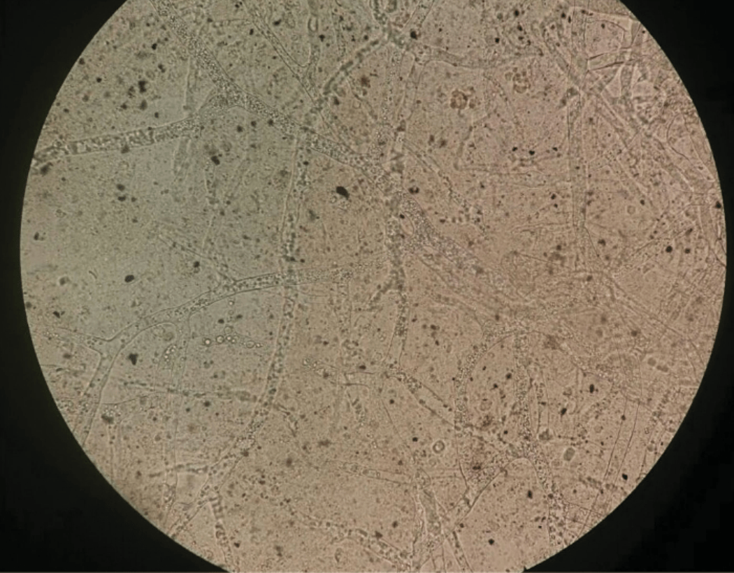 毛霉菌显微镜下图片图片