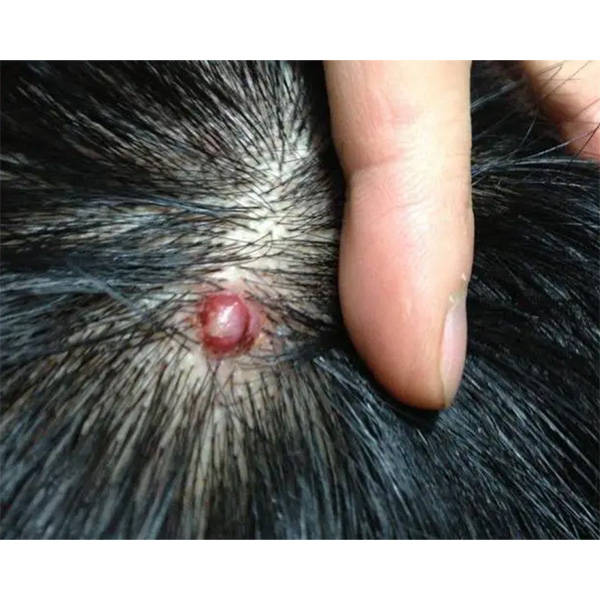 孩子头皮屑多怎么去除最简单方法?国产不错的洗发水排行榜前十名