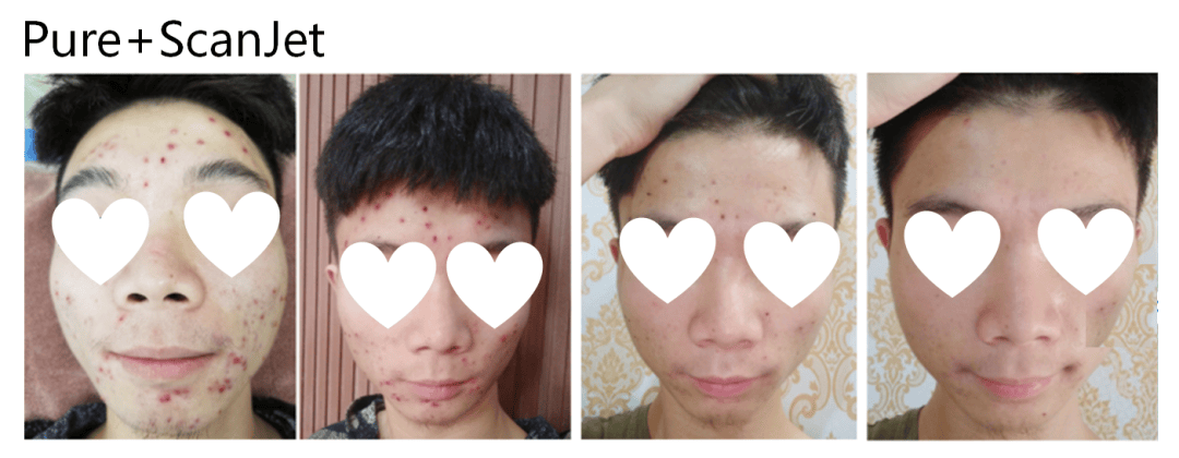 治疗师_皮肤_技术