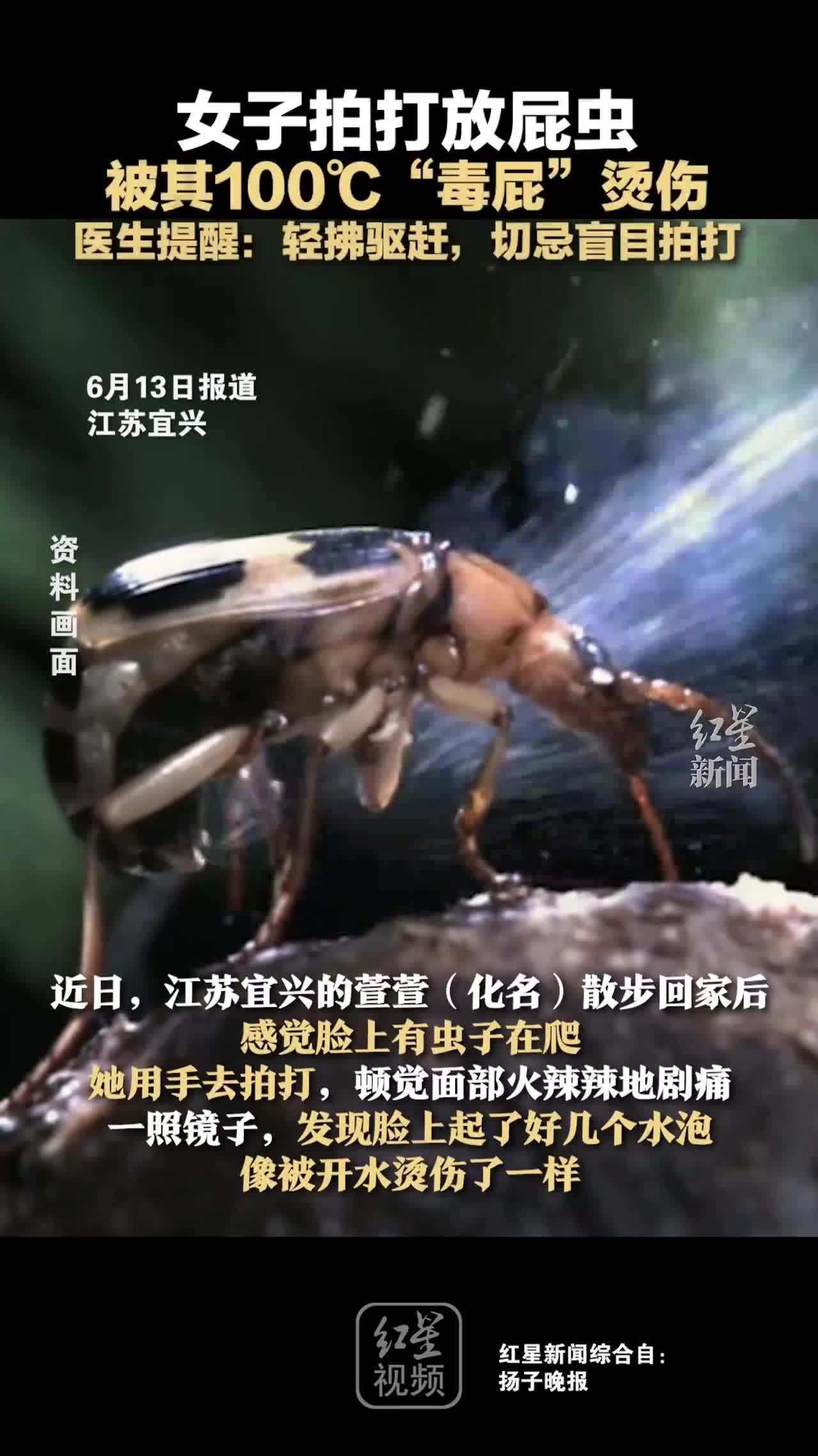 女子拍打放屁虫,被其100℃"毒屁"烫伤,医生提醒:轻拂驱赶,切忌盲目